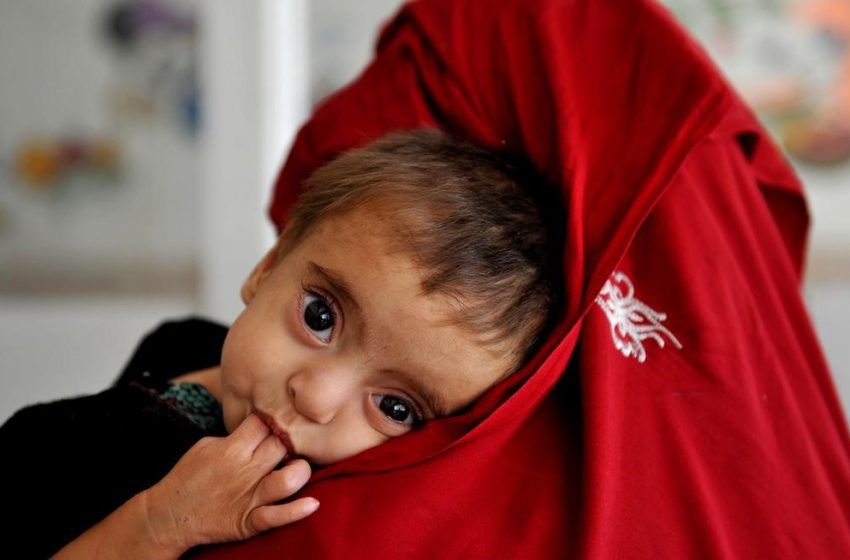  یونیسف: بیش از یک میلیون کودک دچار سوء تغذیه حاد شده اند