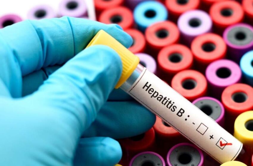  افزایش بیماری هپاتیت «زردی سیاه» در افغانستان